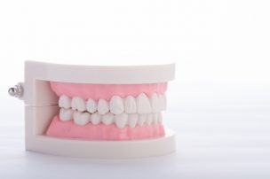 乱れた歯並びが、歯列矯正を必要とする理由